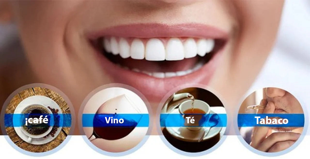 ¡Sonríe Seguro! Blanqueador Dental Profesional