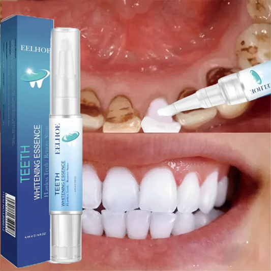 ¡Sonríe Seguro! Blanqueador Dental Profesional