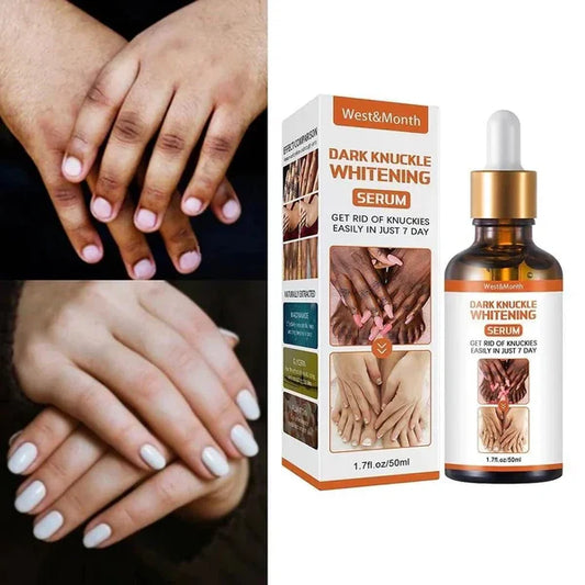 Aceite terapéutico para la acantosis nigricans.