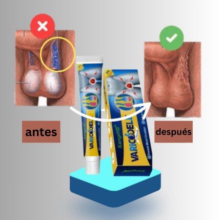 Crema natural para tratar el varicocele