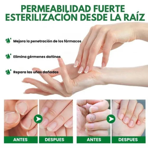 7 días de uñas sin hongos® | Protege y elimina el hongo de tus uñas.